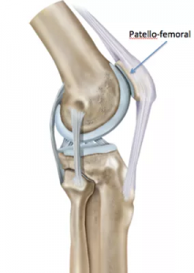 Medial ligament injury - City Hospital, Dehradun