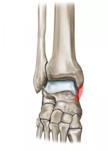 http://cityhospitaldehradun.com/wp-content/uploads/2019/01/xmedial-ligament.png.pagespeed.ic_.wXpyrYYC-Y-215x300.png